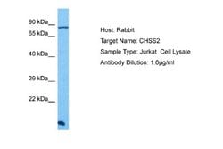 CHSS2 Rabbit anti-Human, Polyclonal, Novus Biologicals 0.1ml; Unconjugated:Antibodies,